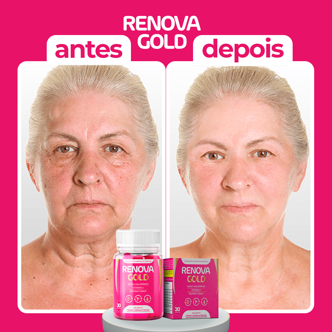 Antes-e-depois2